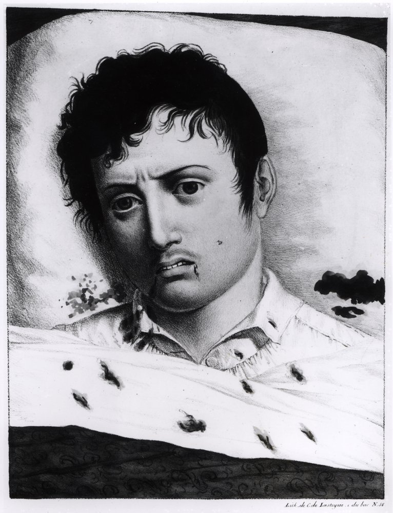 Observation of Yellow Fever, c.1819 by Charles Lasteyrie du Saillant