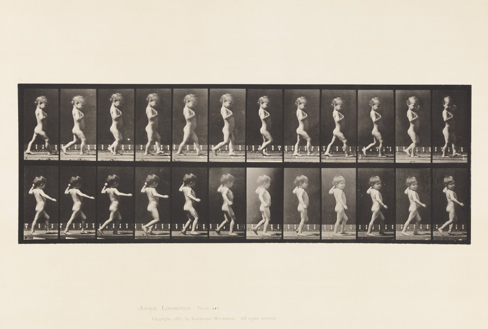Bow Legs; Boy; Spinal Caries; Girl Walking by Eadweard Muybridge