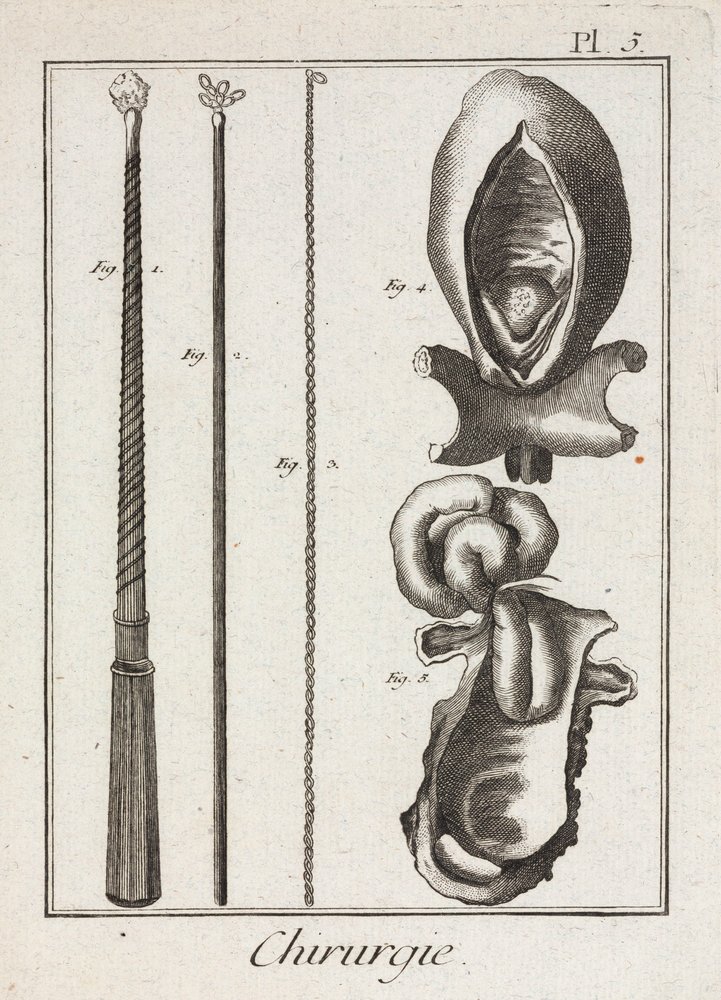 Early-Modern Surgical Instruments and Diagrams of Body Parts