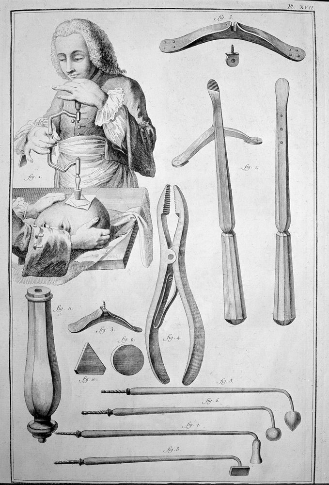 Trepanation of the Skull, Various Instruments
