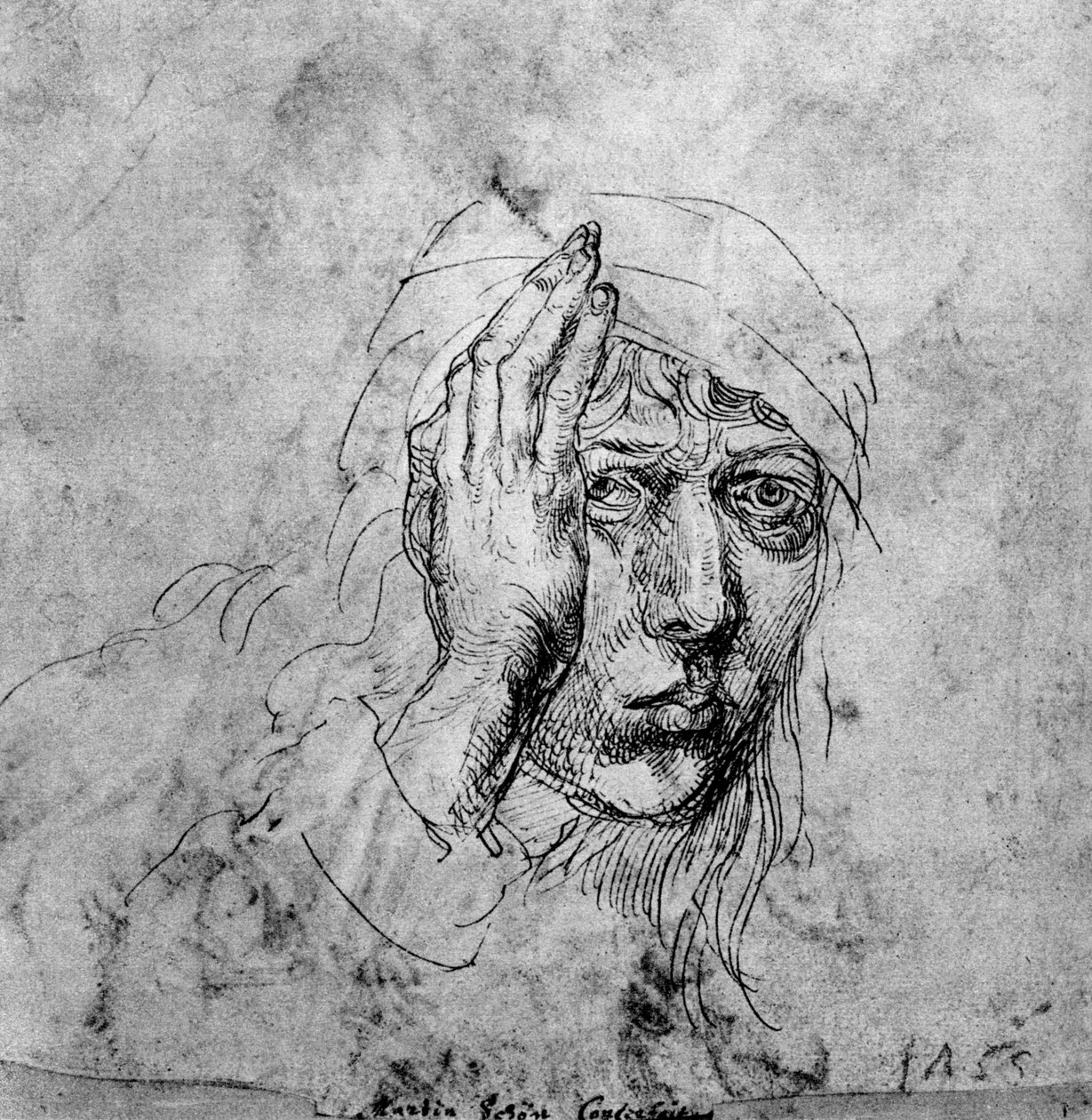 Self Portrait with a Bandage by Albrecht Dürer