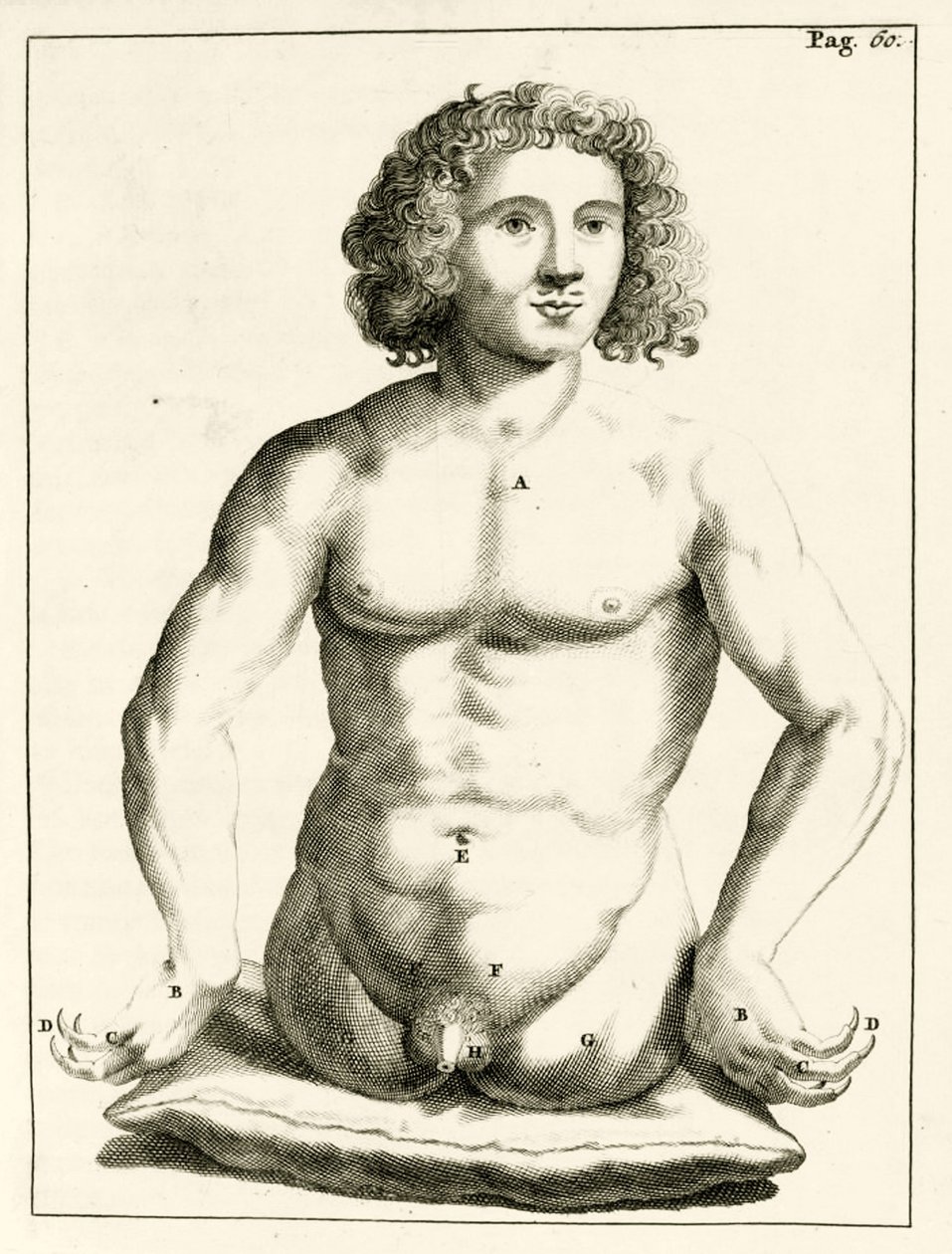 Example of congenital birth defects, from Exercitationes Practicae ...