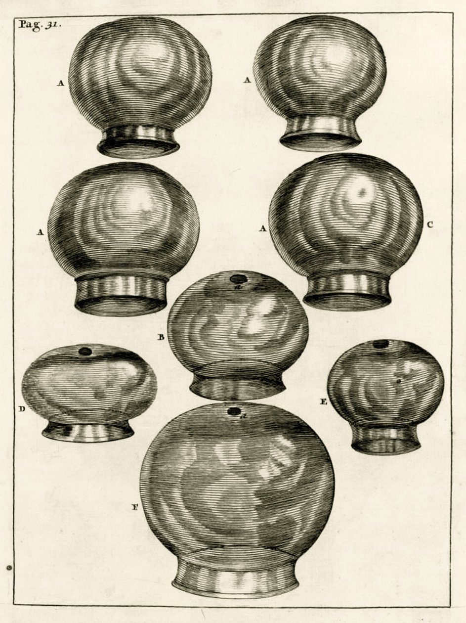 Various cupping glasses, from Exercitationes Practicae circa Medendi Methodum by Frederik Dekkers, 1694 by Dutch School