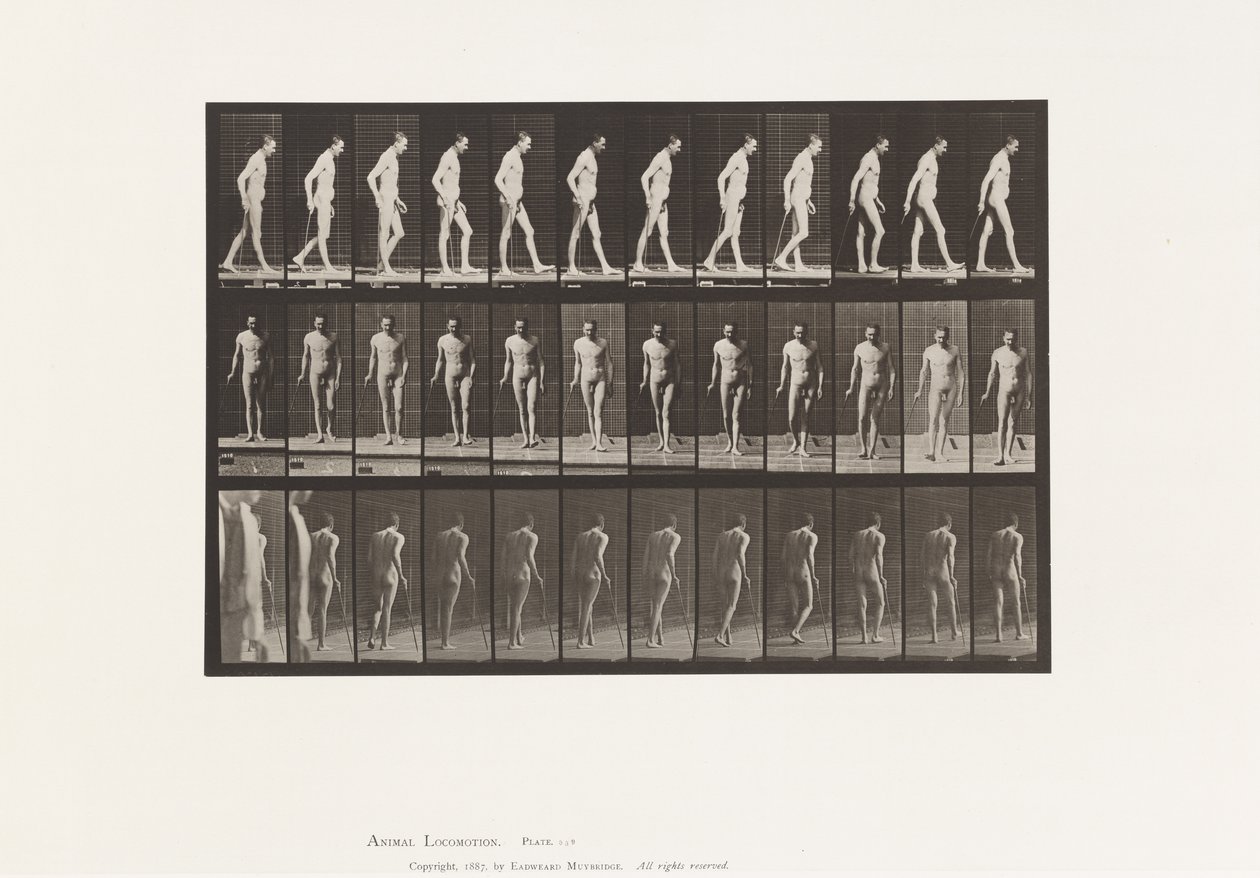 Plate 559. Disseminated Sclerosis; Walking with Cane by Eadweard Muybridge