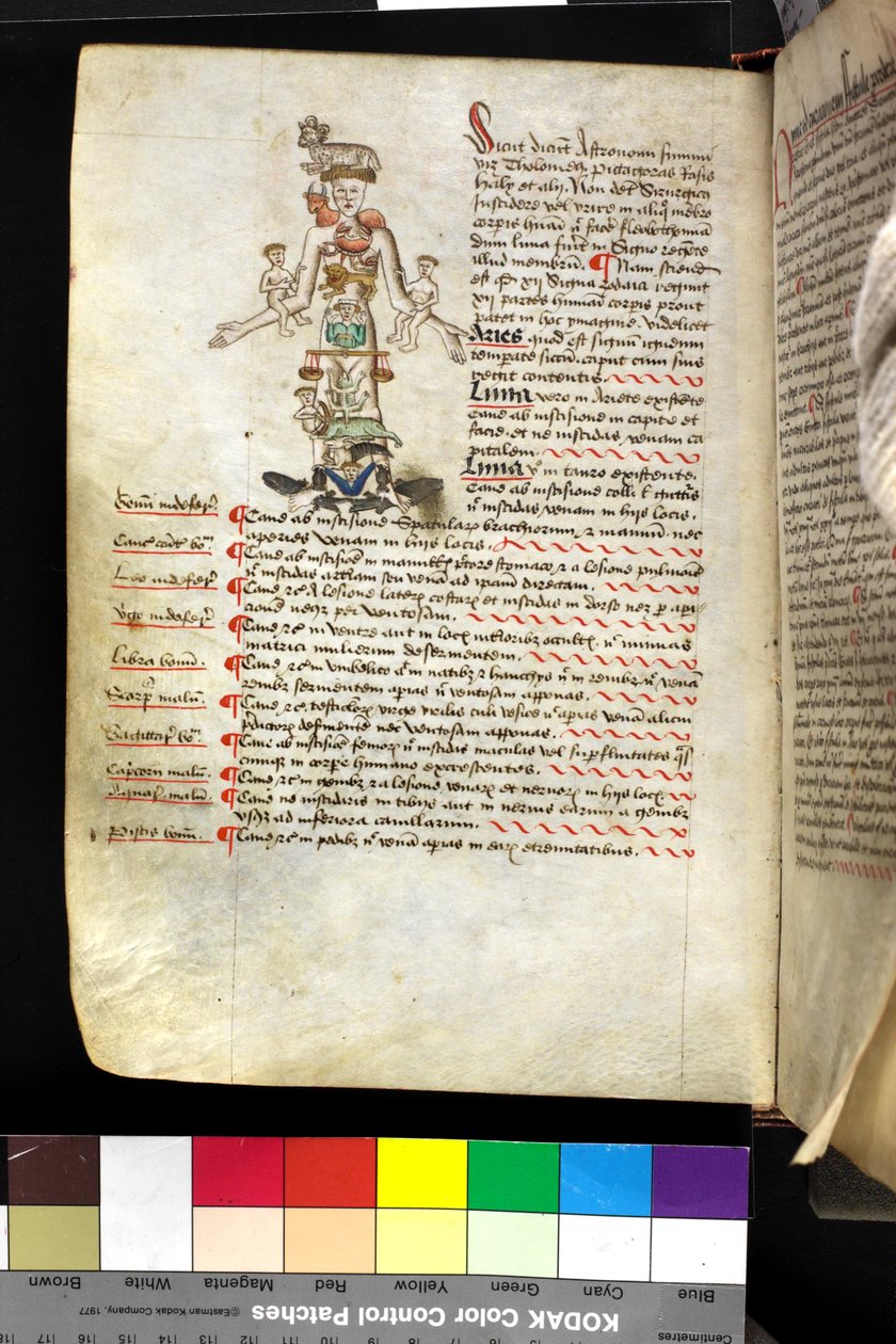 Illustration of a 