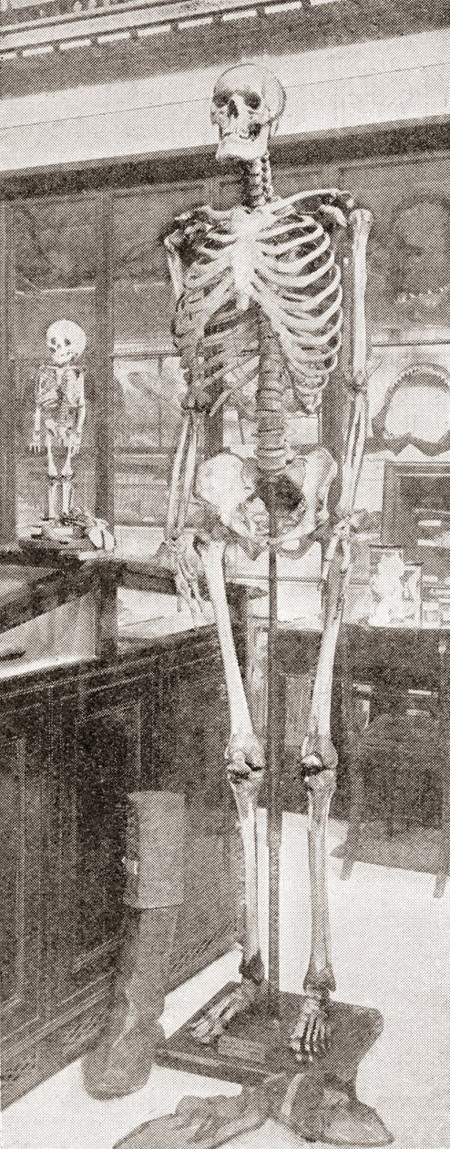 The Skeletons of Charles Byrne by English School