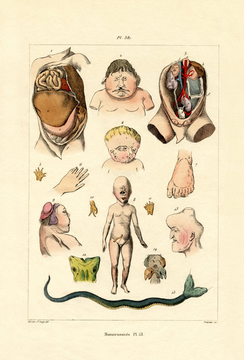 Freak by French School