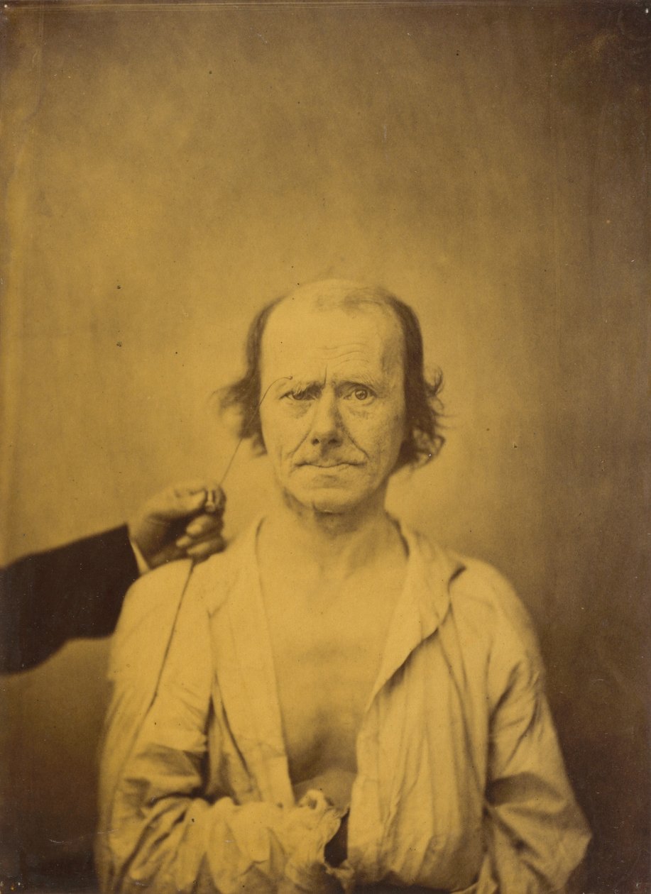Attention (left); Reflection (right) by Guillaume Benjamin Armand Duchenne de Boulogne