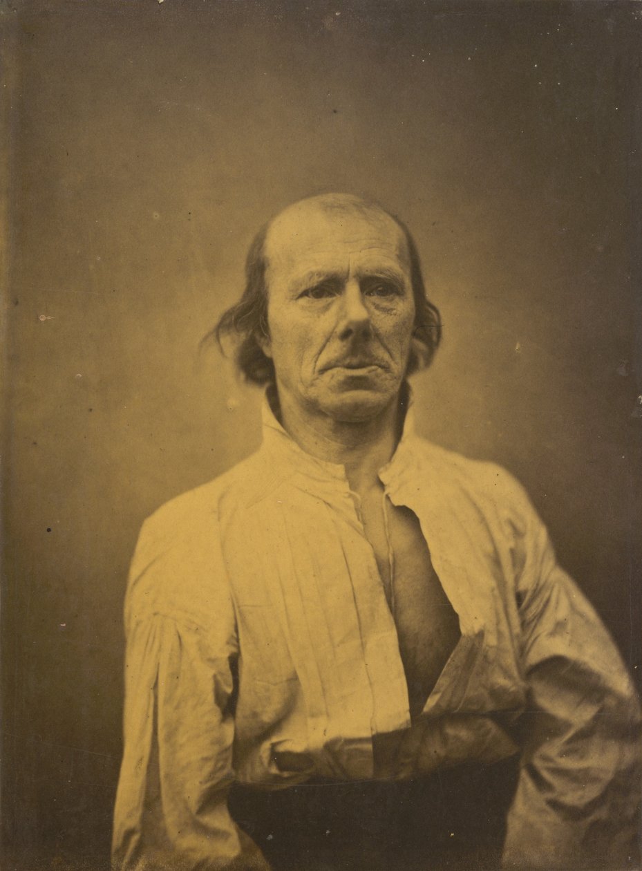 Face in Repose, 1854-1856, Printed 1862 by Guillaume-Benjamin-Armand Duchenne de Boulogne