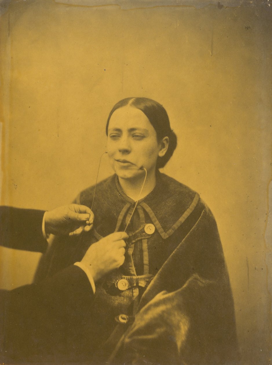 Scornful Disgust (Left); Scornful Laughter (Right), 1854-1856, Printed 1862 by Guillaume-Benjamin-Armand Duchenne de Boulogne