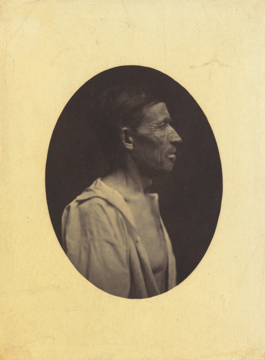 A Portrait, Seen in Profile, of a Man 42 Years Old, Stupefied by the Abuse of Alcohol; His Nose is Aquiline by Guillaume Benjamin Amant Duchenne