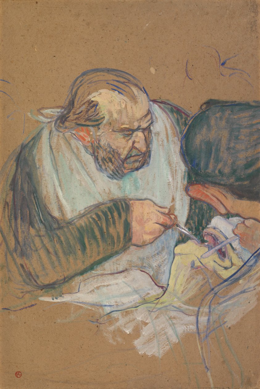 Dr. Péan Operating by Henri de Toulouse-Lautrec