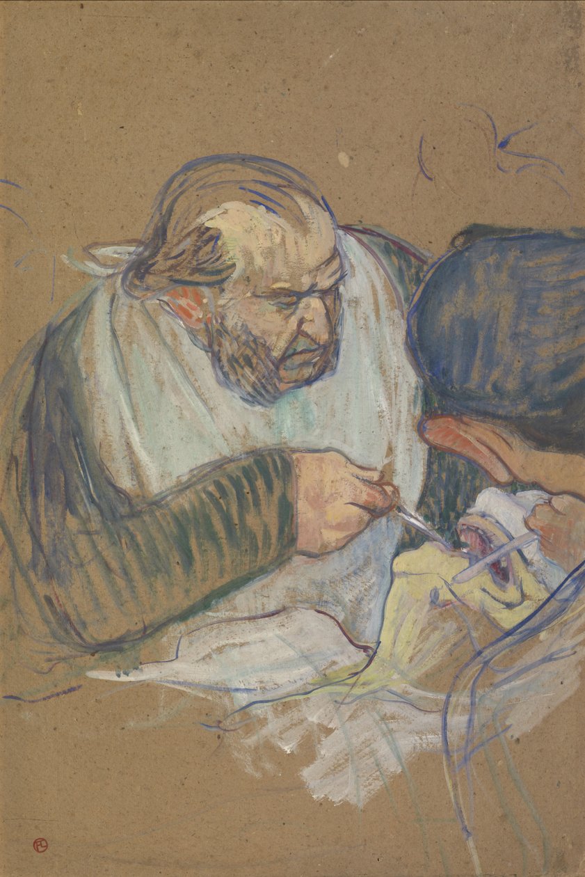 Dr. Péan Operating, 1891-92 by Henri de Toulouse Lautrec