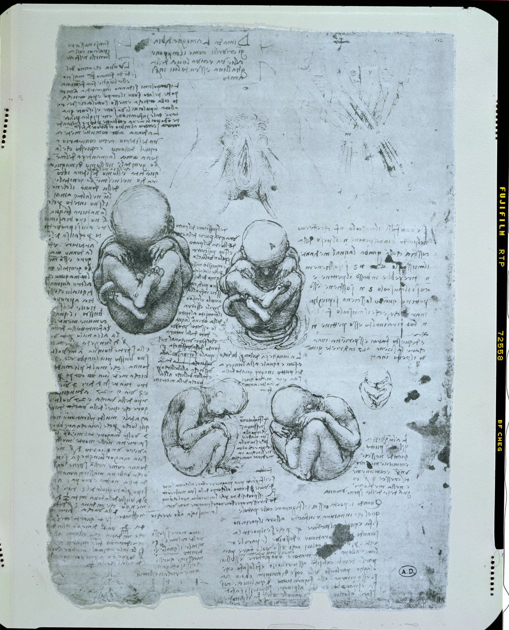 Five Views of a Foetus in the Womb, Facsimile Copy by Leonardo da Vinci