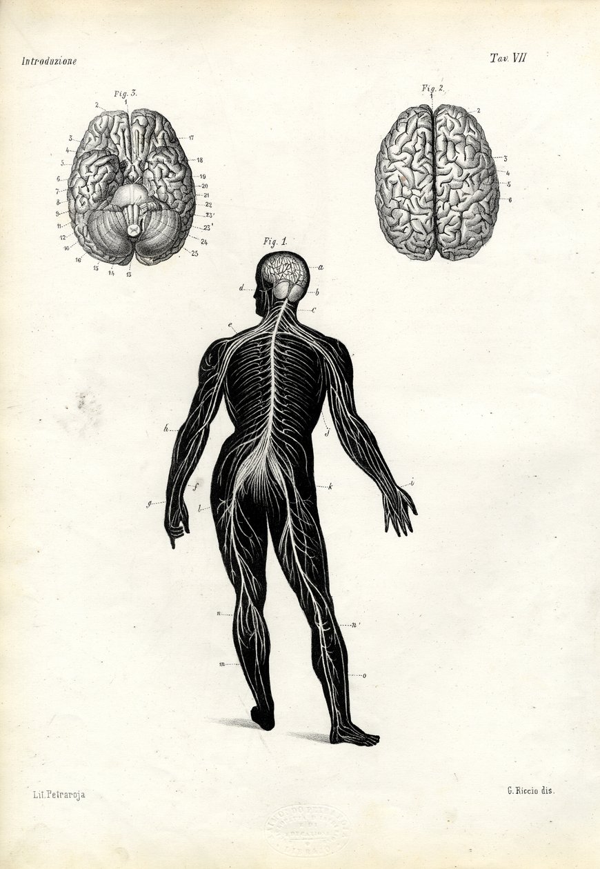 Brain, 1863-79 by Raimundo Petraroja