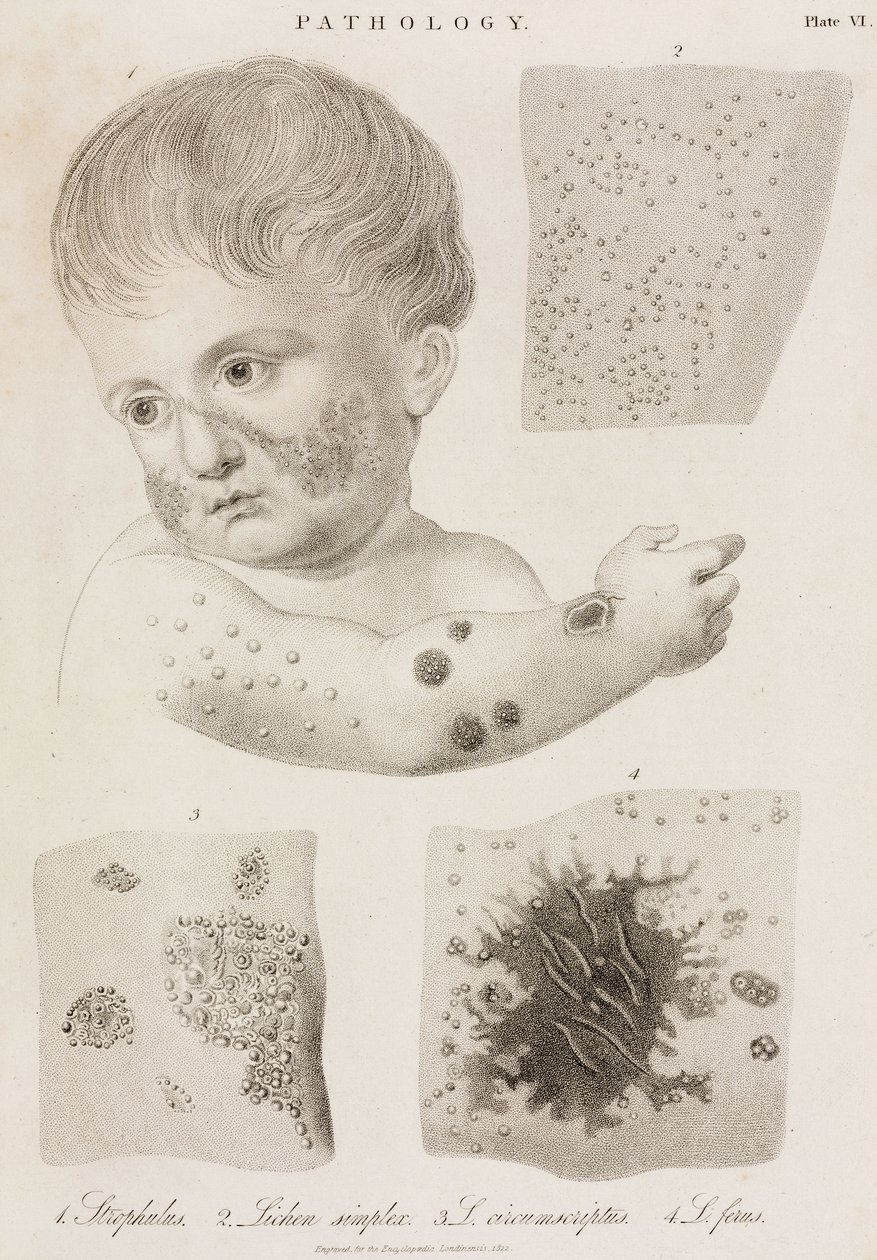 Types of Skin Disease by John Pardon: Buy fine art prints