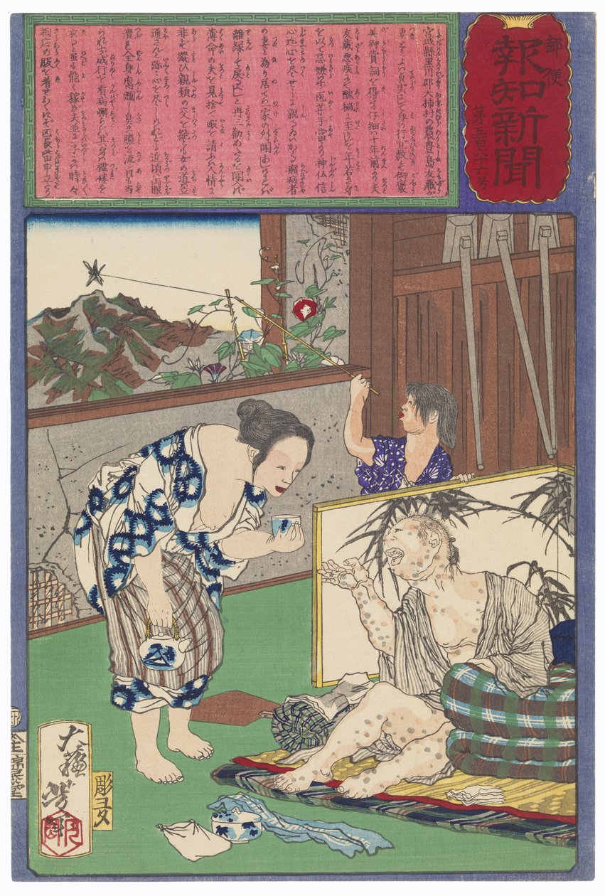 Toshima Tomiyo Who Stayed with Her Leper Husband, Tomozō by Tsukioka Yoshitoshi