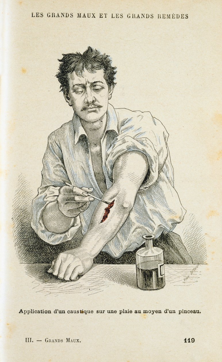 Painting a Wound with an Antiseptic Solution by Unbekannt