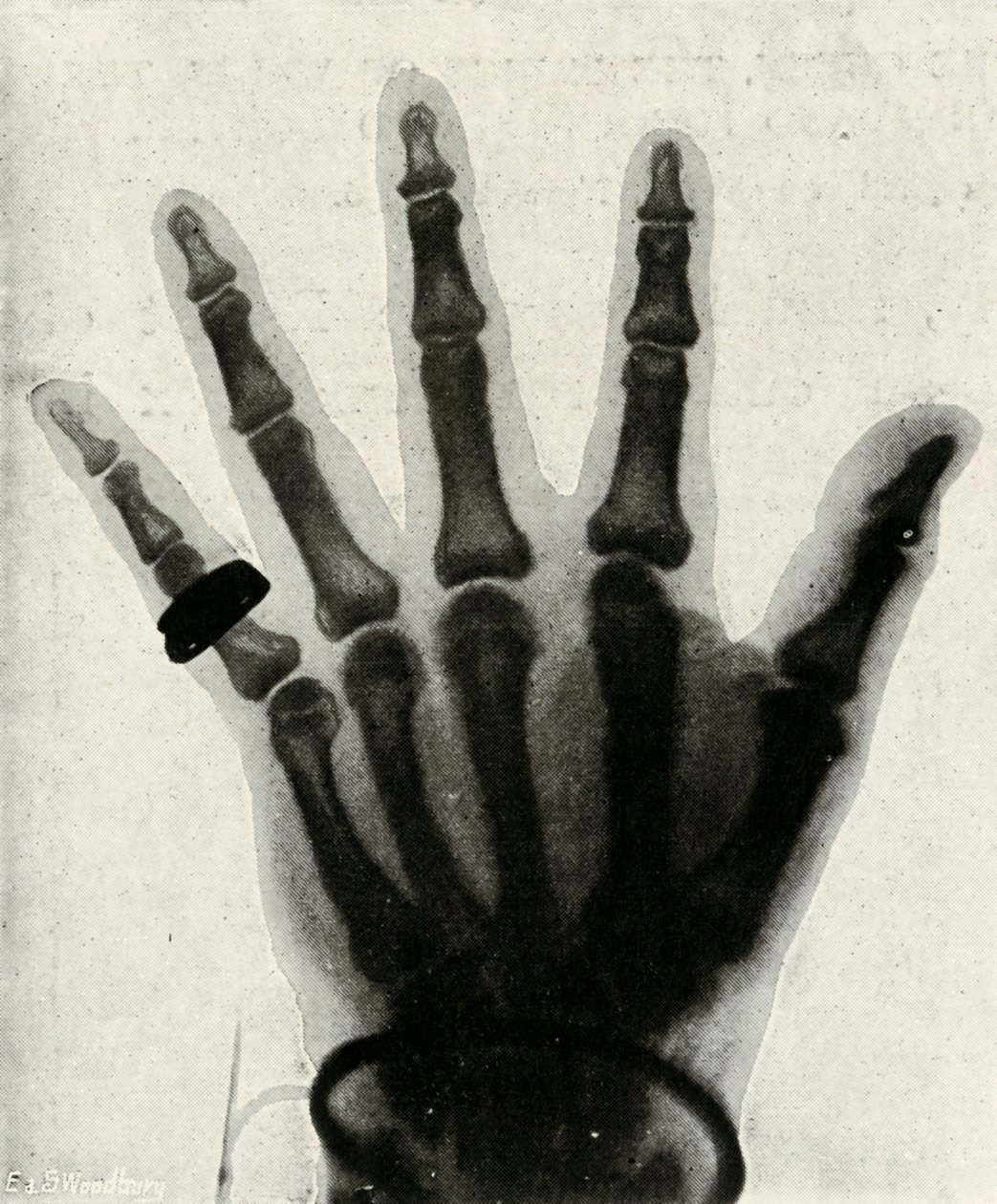 Radiograph of the Hand of H.R.H. The Prince of Wales by Unbekannt