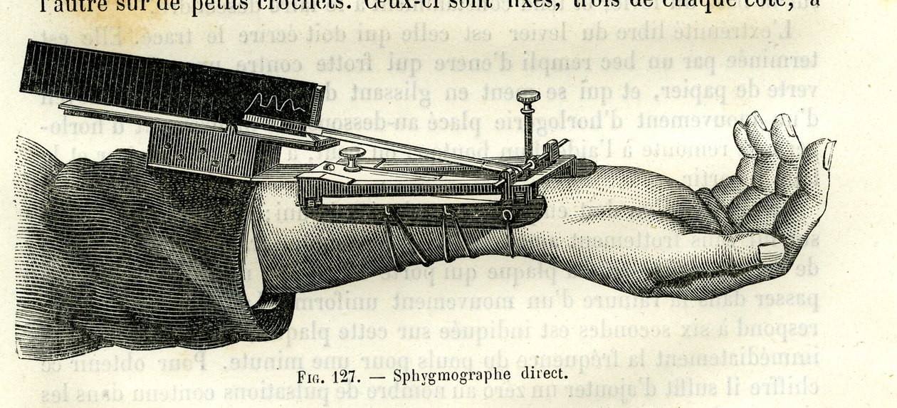Direct sphygmograph by Unbekannter Künstler