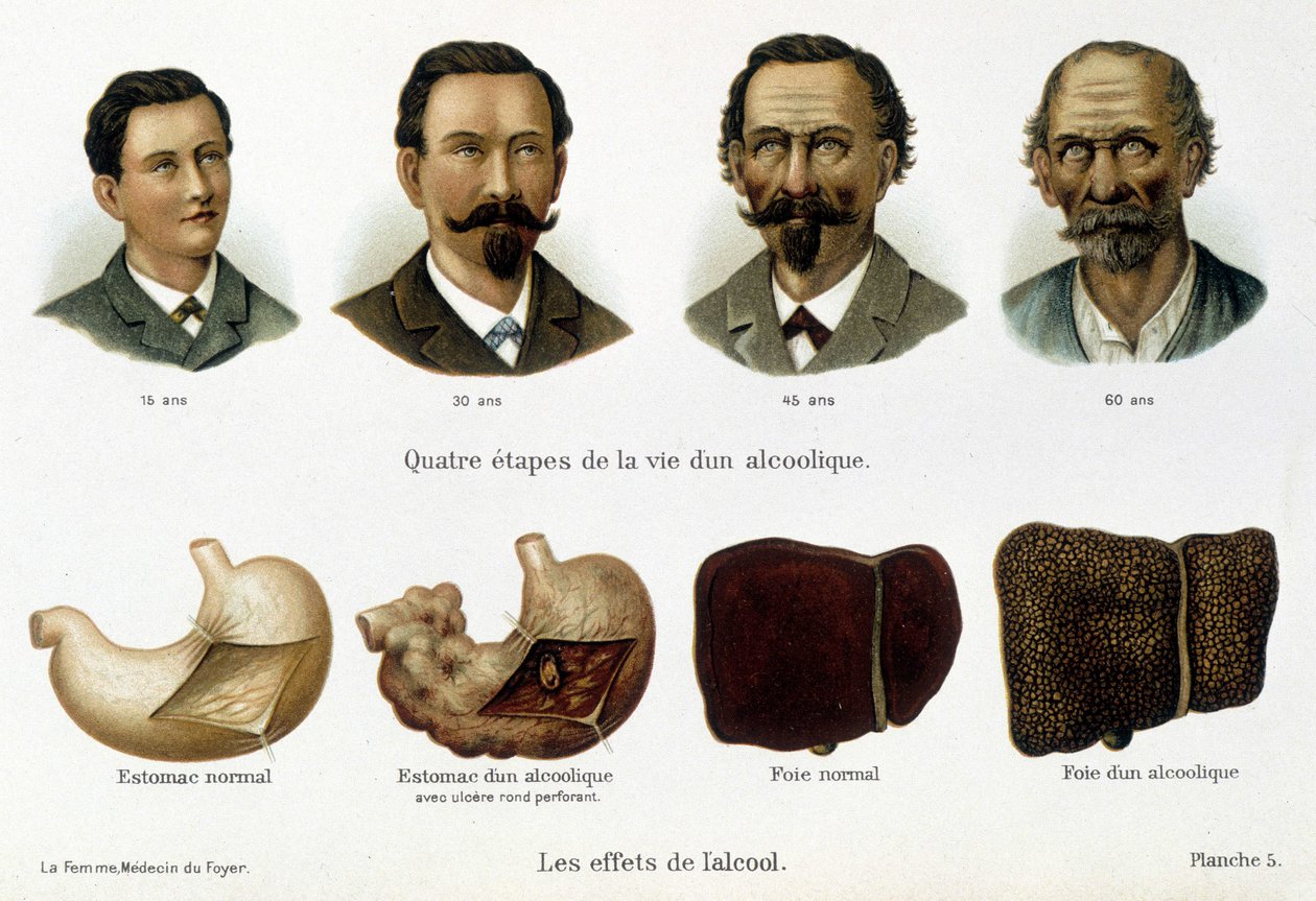 The effects of alcohol: the four stages of an alcoholic's life ...