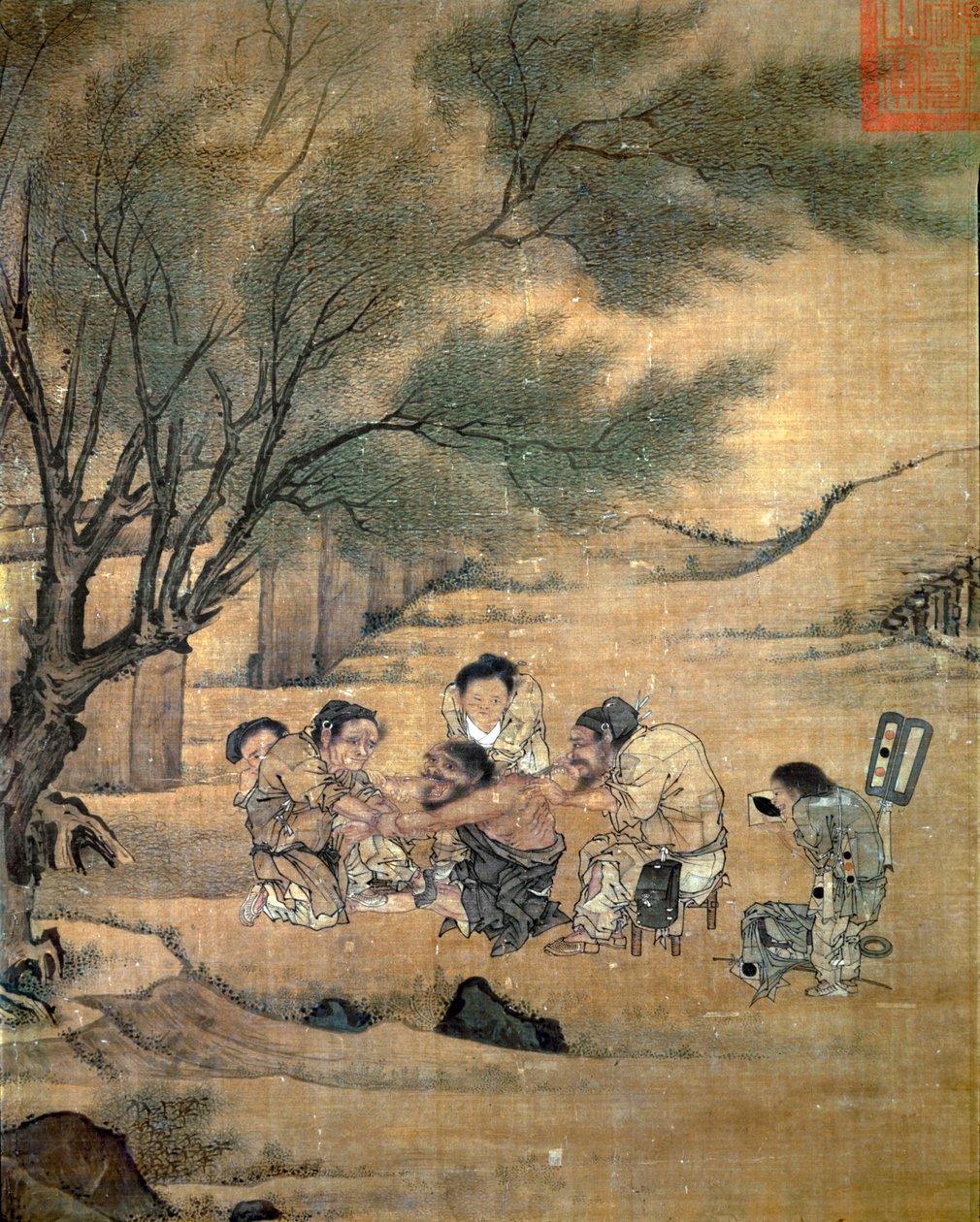 Country Doctor Applying a Painful Cure of Moxibustion by Unknown artist