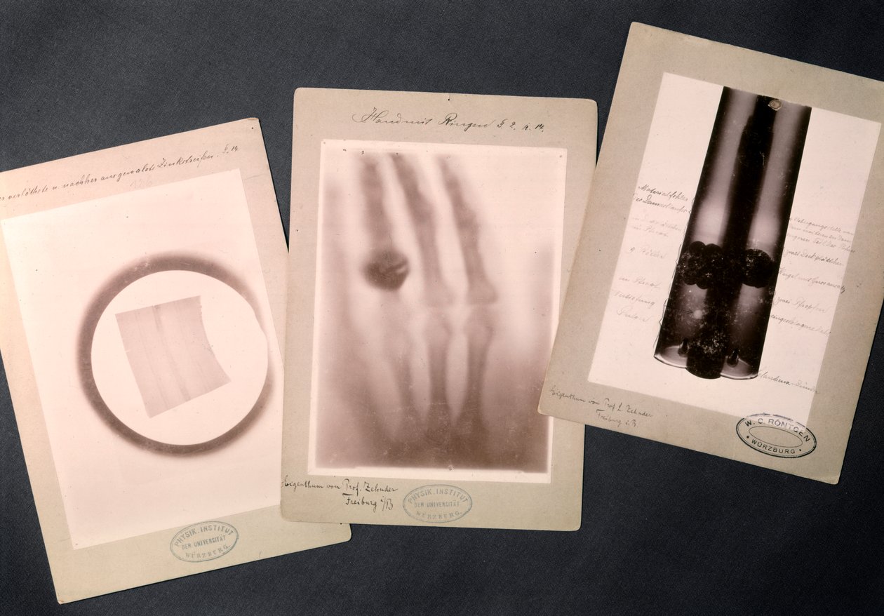Original Radiographies by Roentgen by Wilhelm (after) Röntgen