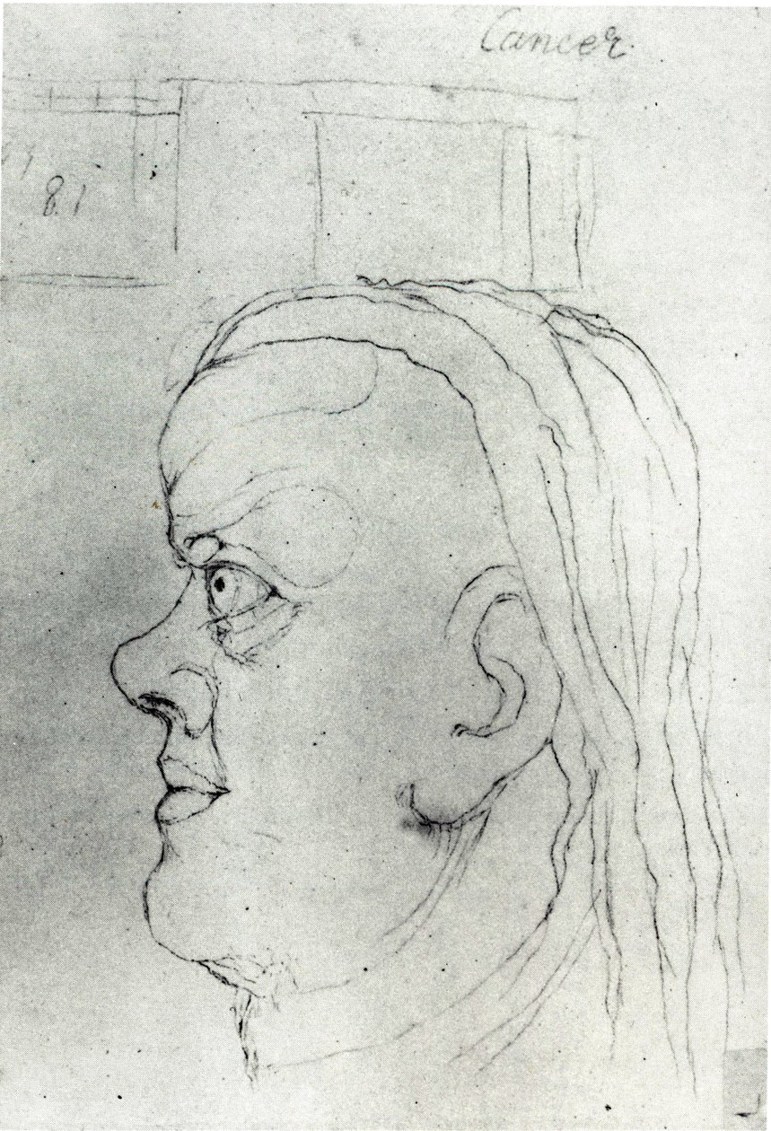 Head of Cancer by William Blake