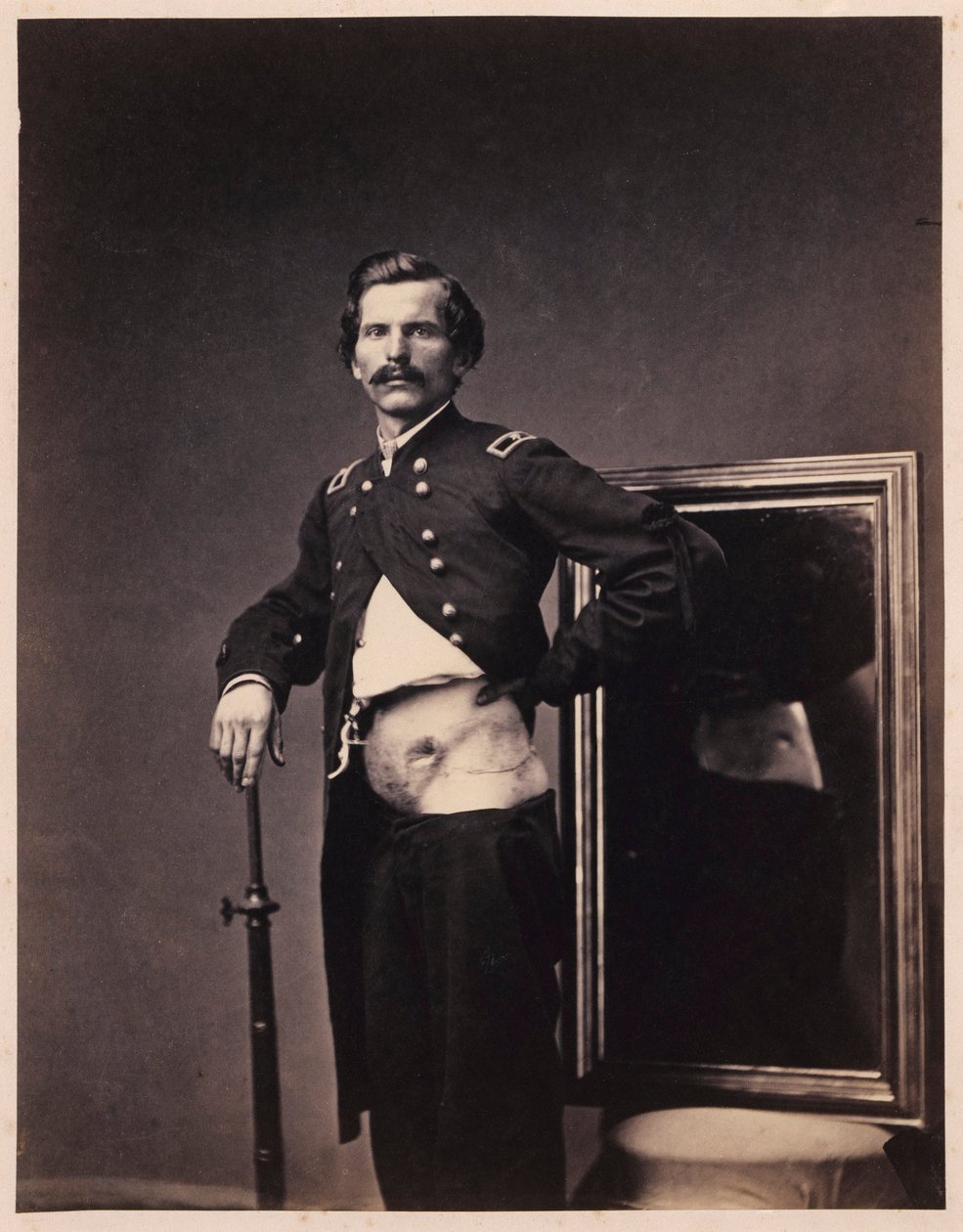 Major H. A. Barnum, Recovery after a Penetrating Gunshot Wound of the Abdomen with Perforation of the Left Ilium, from the Photographic Catalogue of the Surgical Section by William Bell