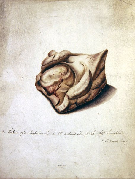 Study of the Brain II, c.1850 by William Lover