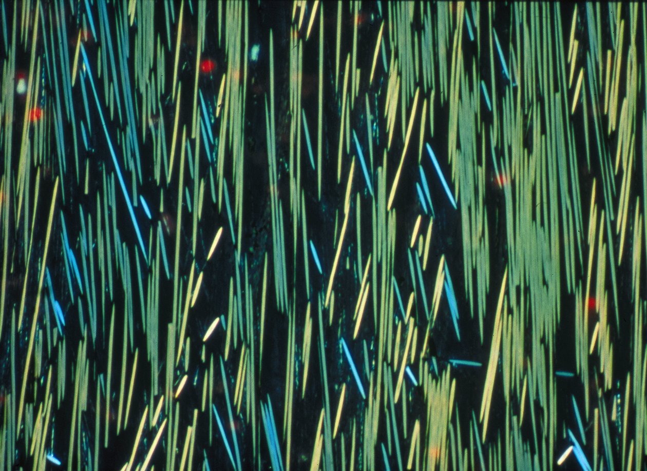 PMC Carbon Fibre in a Polymer Matrix by Frederick (attr. to) Barnard