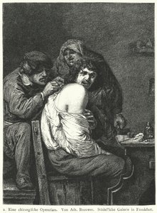 The Back Operation by Adriaen (after) Brouwer