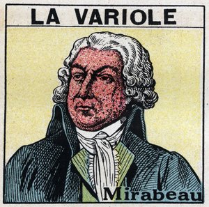 Portrait of Honore Gabriel Riqueti, Count of Mirabeau (1749-1791) with the face of figure by smallpox. To avoid scars caused by smallpox, patients should be treated in rooms or enter only red light, free of ultraviolet rays. Anonymous illustration from 192
