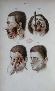 Anatomical plate of the upper jaw by C and Huette E. Bernard