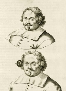 An example of cupping, from Exercitationes Practicae circa Medendi Methodum by Frederik Dekkers, 1694 by Dutch School