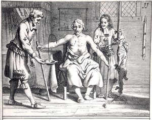 Blood transfusion from a dog, from Armamentarii Chirurgici by Johannes Schultes published in Amsterdam, 1671