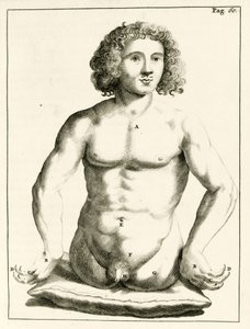 Example of congenital birth defects, from Exercitationes Practicae circa Medendi Methodum by Frederik Dekkers, 1694 by Dutch School