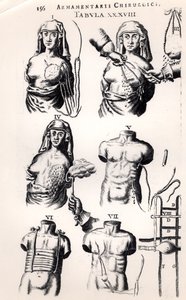 Operating on breast cancer, from Armamentarii Chirurgici by Johannes Schultes published in Amsterdam, 1672