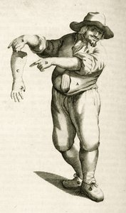 Removing dead skin with pustules, from Exercitationes Practicae circa Medendi Methodum by Frederik Dekkers, 1694 by Dutch School