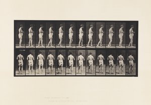 Plate 542. Multiple Cerebro-Spinal Sclerosis - Walking by Eadweard Muybridge