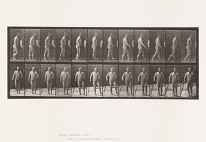 Hemiplegia; Walking with Cane by Eadweard Muybridge