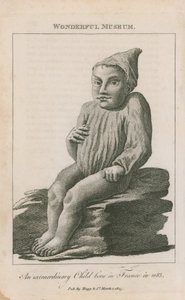 An Extraordinary Child Born in France in 1683 by English School