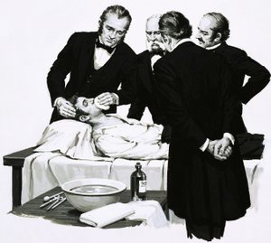 Dr Crawford Long renders a student unconscious before performing an operation by English School