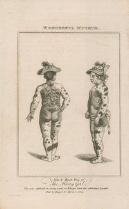 Side and Back View of the Hairy Girl by English School
