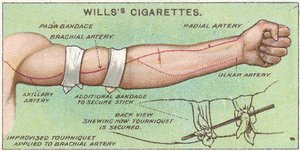 Tourniquet, no.11 from the First Aid series of Wills Cigarettes cards, 1913 by English School