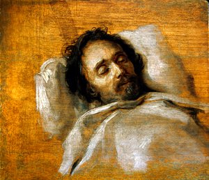 A Study of a Man on his Deathbed by Flemish School