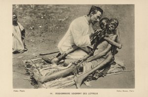 Missionary Tending to Lepers by French Photographer