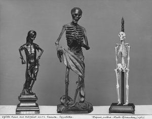 Corpse, Skeletons