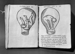 Foetus in the womb, illustration from the so-called Rhodion manuscript by French School