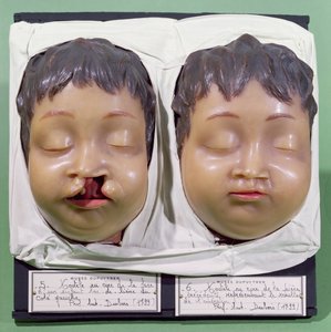Model showing a child